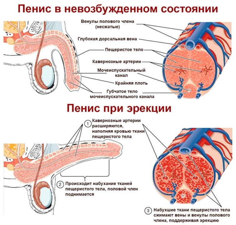 Эректильная дисфункция — Википедия