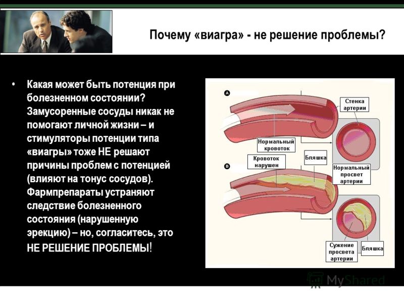 Как действует Виагра принцип действия препарата и влияет ли он на женщин
