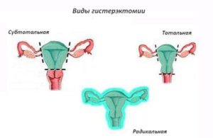 Лучших средств для повышения потенции мужчин