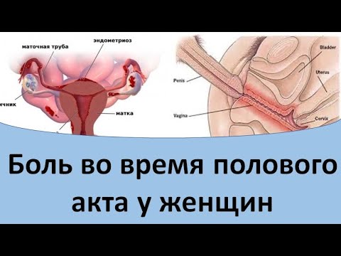 Преждевременное семяизвержение, быстрая эякуляция у мужчин
